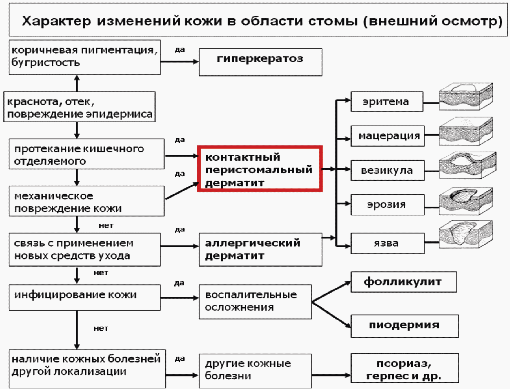 Дерматит что это и схема лечения