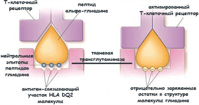 Целиакия у детей презентация